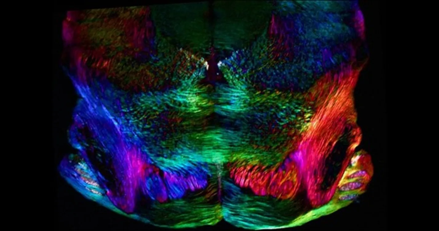 Brain Photos Gallery