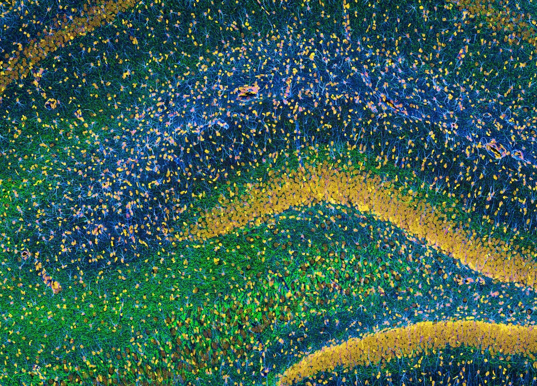 Brain Photos Gallery